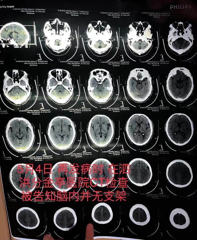 因脑梗去世老人曾被医生隐瞒未植入支架，医院和医生该担何责？