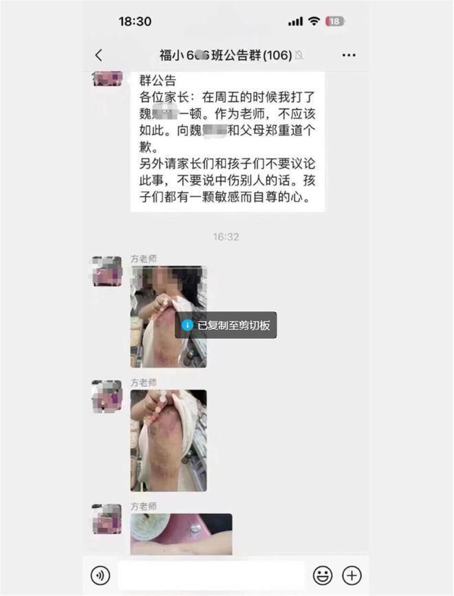 教师打伤学生后群内道歉反获多名家长安慰感谢？当地教育局介入