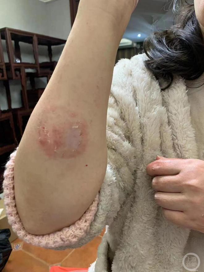 长沙一上市公司创始人被指打断妻子七根肋骨遭刑事立案后取保,当事人否认家暴