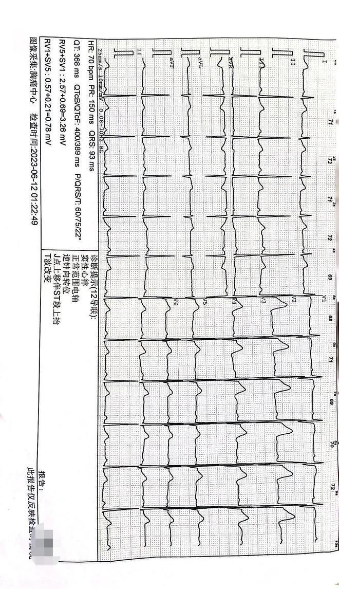 成都地铁回应“被冤枉偷拍男子决定起诉维权”：每节车厢都有监控，遇类似事情建议报警