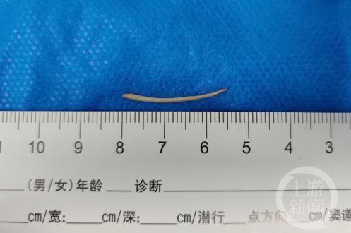 女子花52元取鱼刺称“医院赚大钱”被怼，医院回复：明白人还是很多的