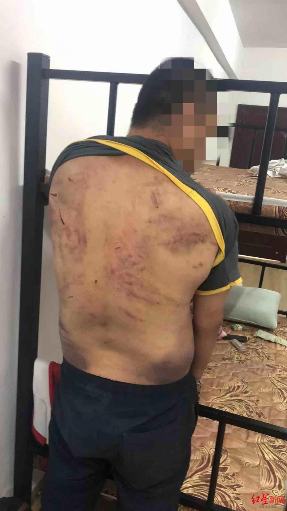 男子回忆被骗去泰国又拐至缅甸:遭到勒索和电击,向园区投诉后终被当地军方救出