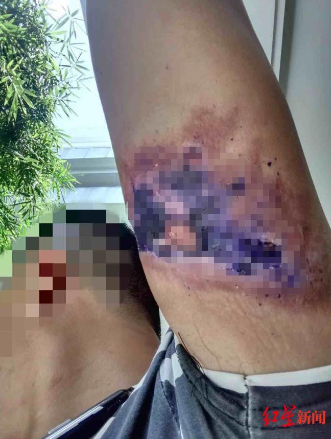 男子回忆被骗去泰国又拐至缅甸:遭到勒索和电击,向园区投诉后终被当地军方救出