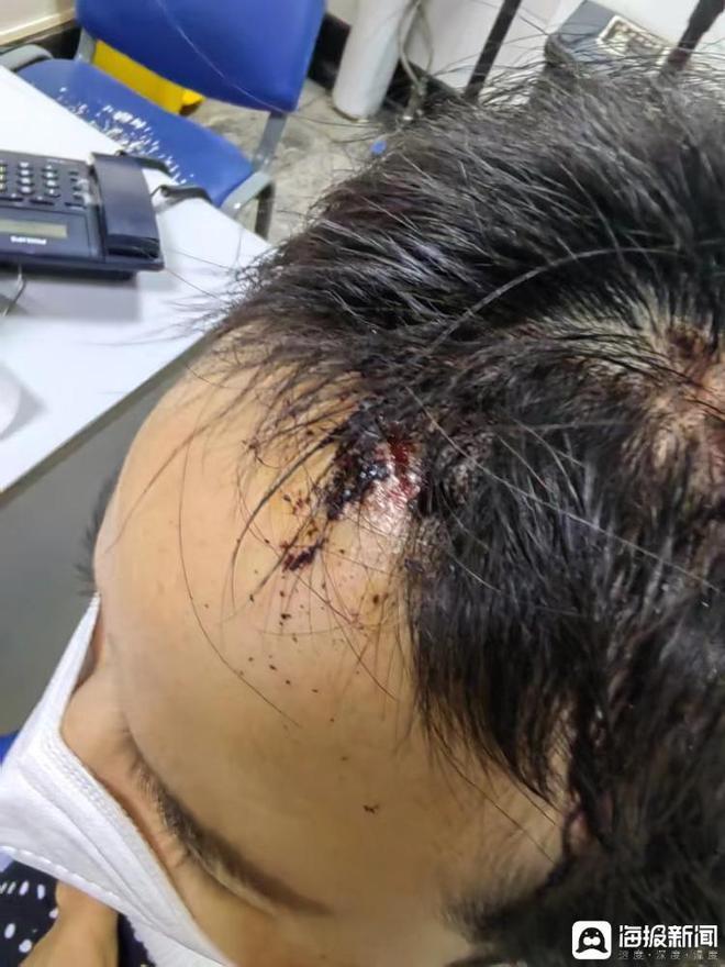 对话“两年被家暴16次”女子:为什么我逃也逃不了,离也离不掉