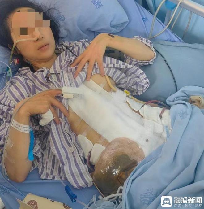 对话“两年被家暴16次”女子:为什么我逃也逃不了,离也离不掉