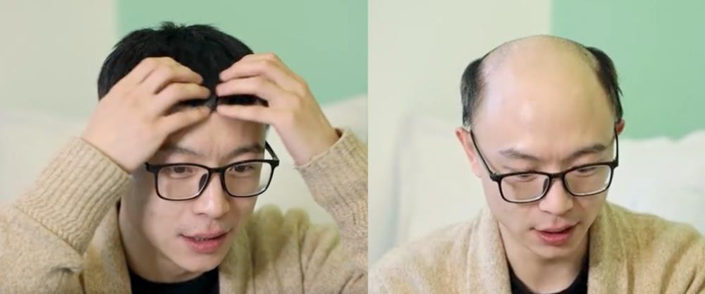 秃头人最后的倔强：假发不被发现