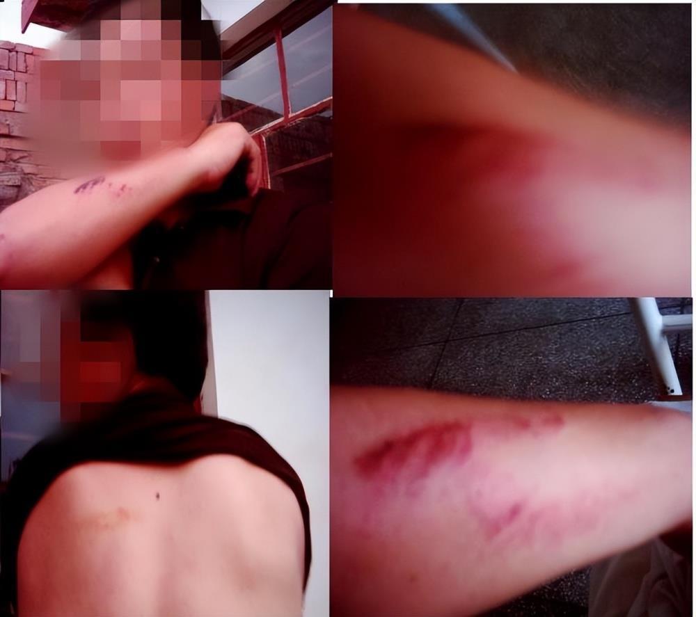 兄弟俩被控故意伤害：申诉16年终获无罪，伤者从重伤变轻伤又变轻微伤