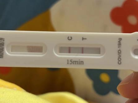 女子自述5次感染新冠：仍活蹦乱跳，要用平常心看待
