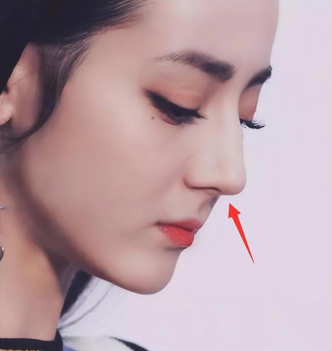 迪丽热巴受伤后露面！鼻子撞伤后遮挡严实，穿三千元凉鞋