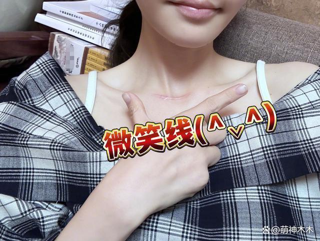 专家发文质疑冯提莫，直言她发布不实言论制造甲状腺癌焦虑