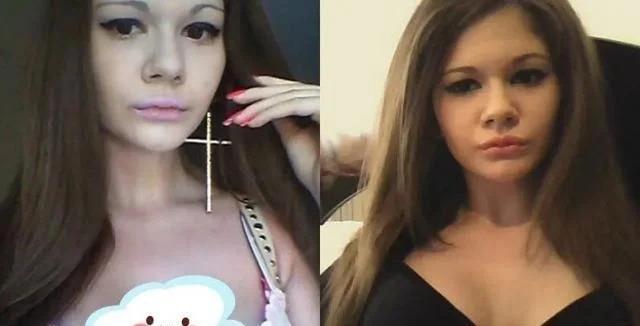 梦想当芭比！25岁网红整容43次变梁朝伟同款香肠唇