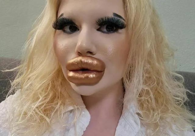 梦想当芭比！25岁网红整容43次变梁朝伟同款香肠唇