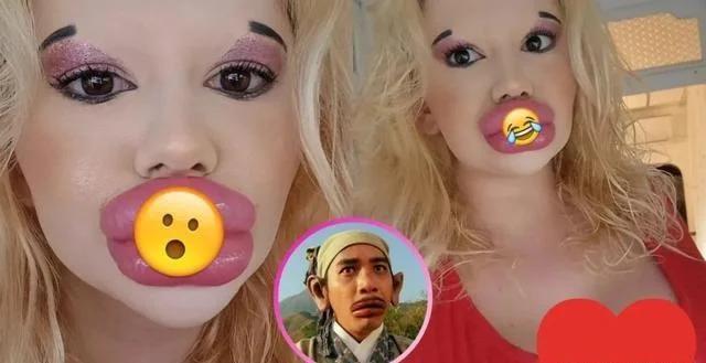 梦想当芭比！25岁网红整容43次变梁朝伟同款香肠唇