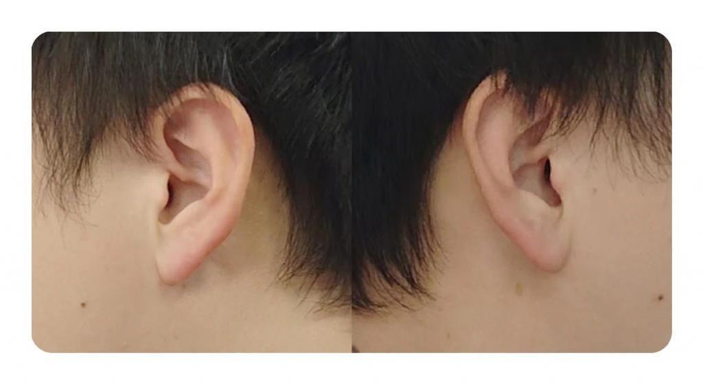 愿称其为年度降噪标杆，索尼 WF-1000XM5 降噪豆 5 体验