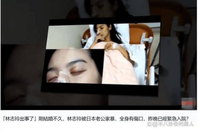 “被家暴”了4年的林志玲，坚持嫁给日本人到底值不值得？