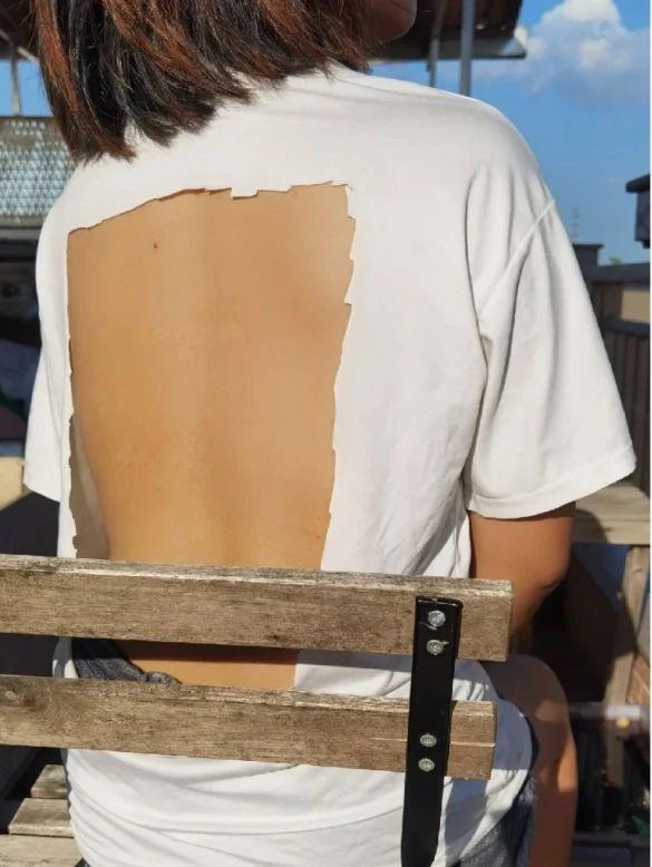 0 成本晒背，全民皆宜的养生方式走红网络.