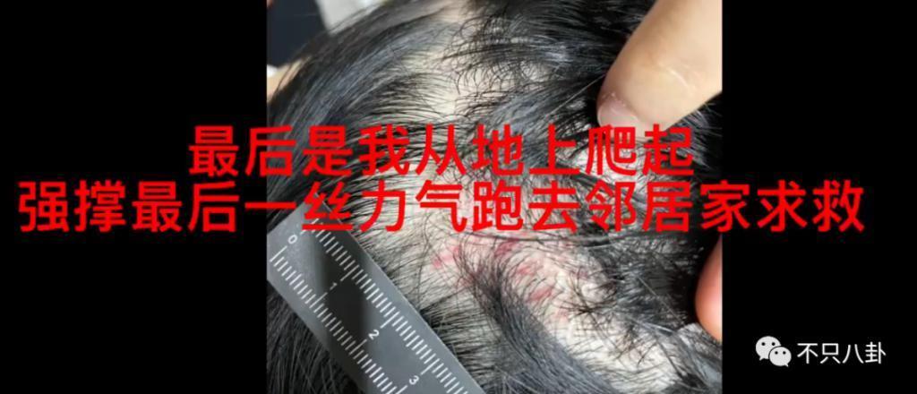经历了出轨家暴哭穷的地狱式婚姻，她竟然还选择原谅他？