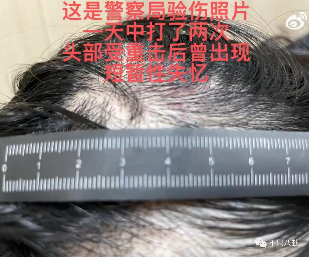 经历了出轨家暴哭穷的地狱式婚姻，她竟然还选择原谅他？