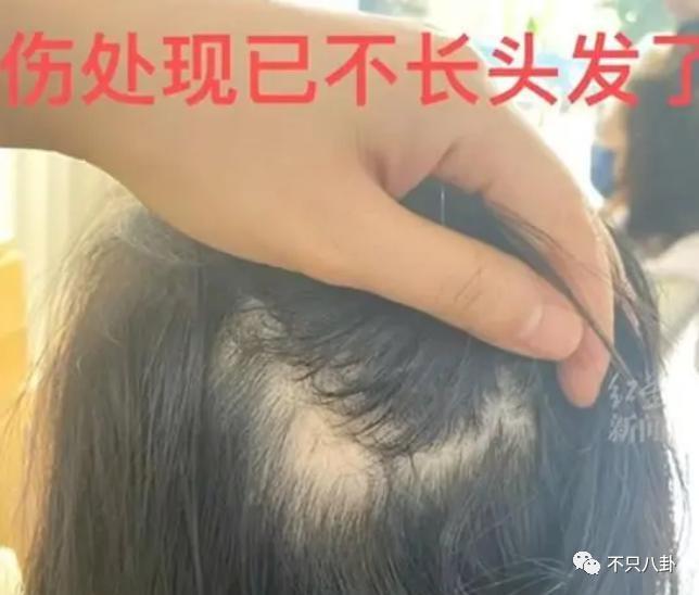 经历了出轨家暴哭穷的地狱式婚姻，她竟然还选择原谅他？