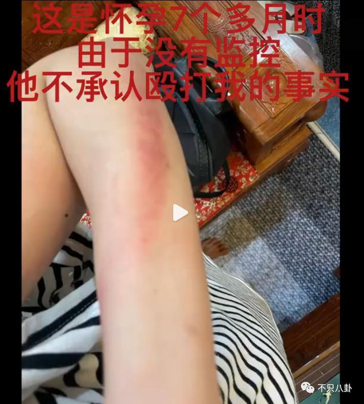 经历了出轨家暴哭穷的地狱式婚姻，她竟然还选择原谅他？