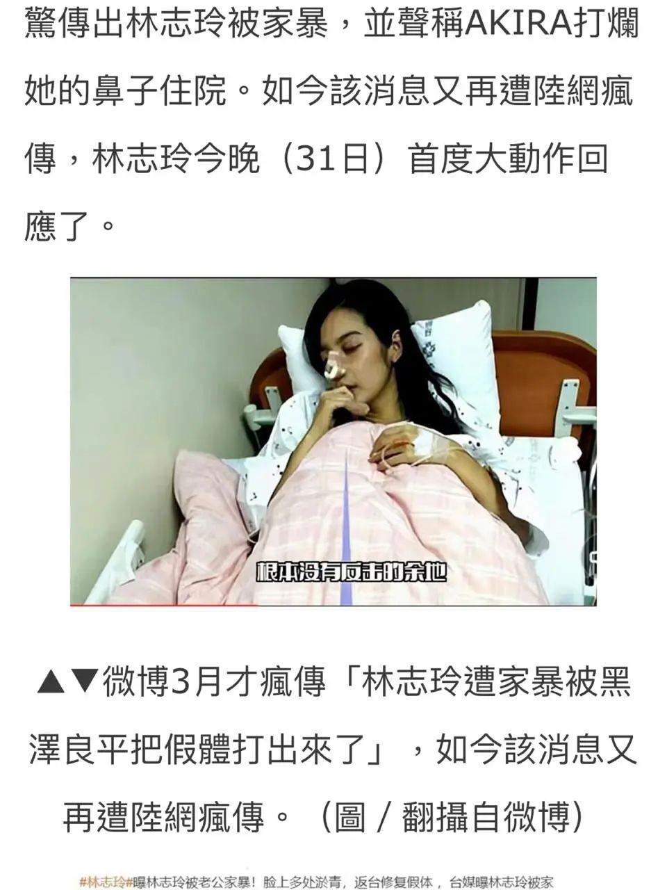 “林志玲被家暴，隆鼻假体被打出”？经纪人回应