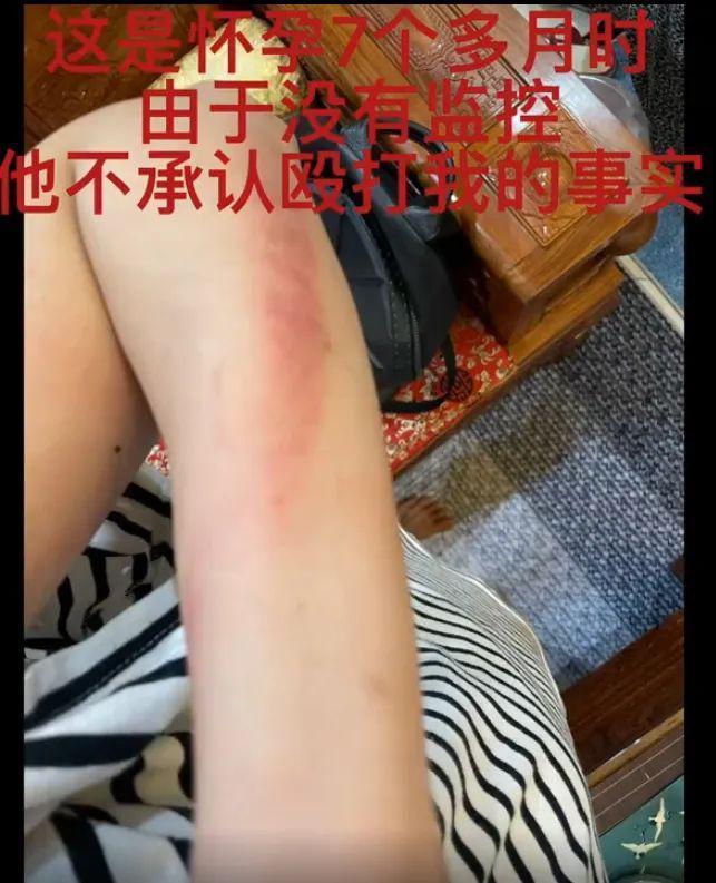 这瓜，有点炸裂……