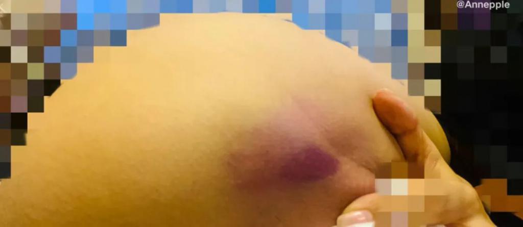 这瓜，有点炸裂……