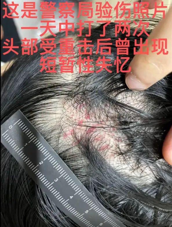 这瓜，有点炸裂……