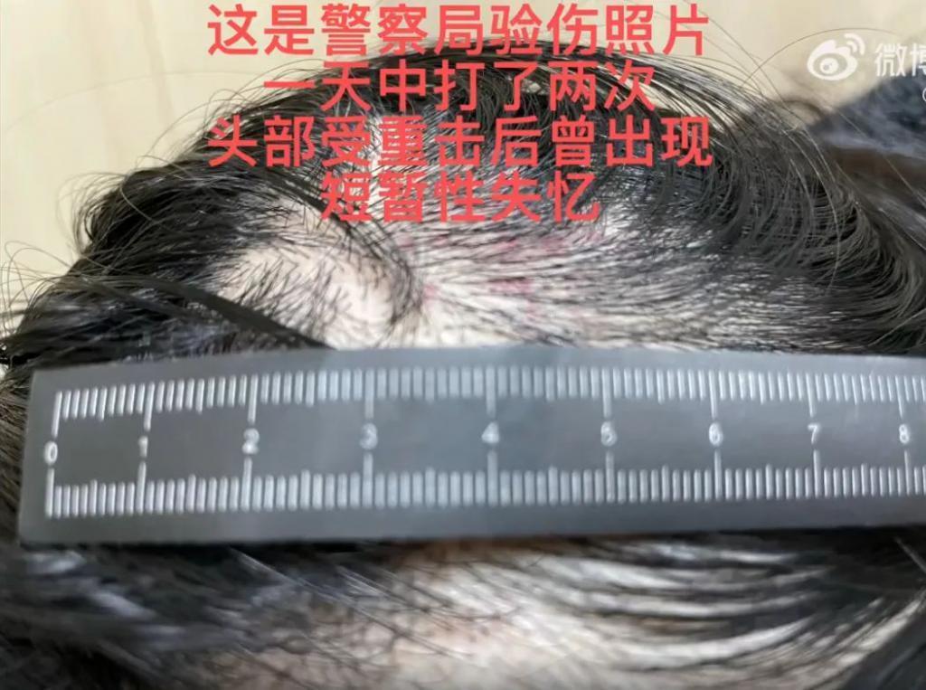 这瓜，有点炸裂……