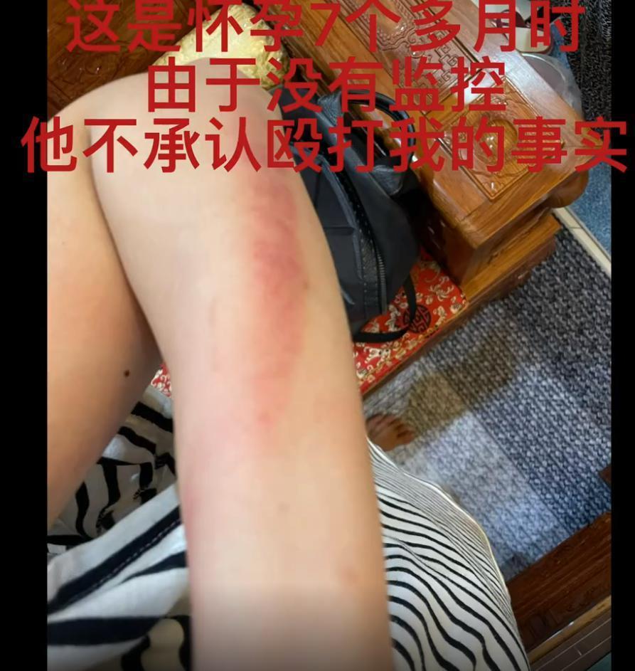 天啊！怀孕7个月被暴打，监控全都曝光了！
