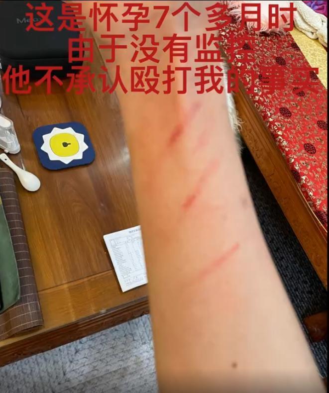 这瓜后续，让人目瞪口呆啊…