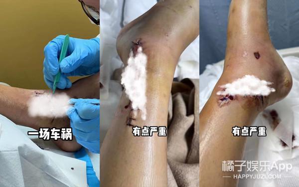 还记得陈学冬吗？车祸之后的他搞起了直播？