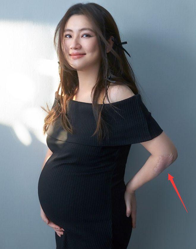 Selina挺孕肚拍大片：手臂疤痕明显 孕期水肿严重
