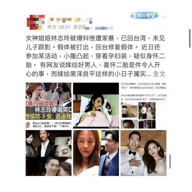 林志玲首次回应家暴！此前疯传日本老公出轨，其患抑郁症自杀未遂
