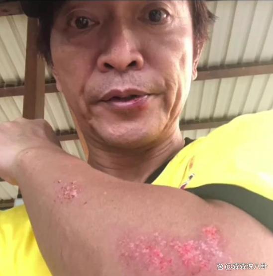 60岁吴宗宪录节目不慎摔伤，手脚及嘴角擦伤出血他还在笑