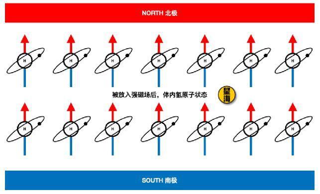 工业皇冠的宝石又少了一颗，这次轮到核磁共振设备了