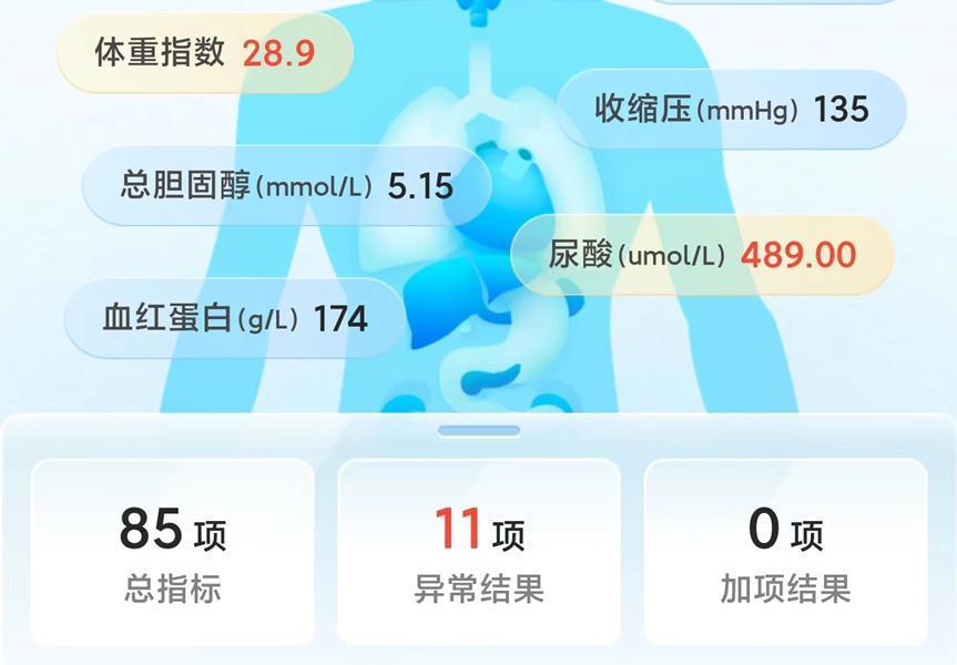 为了让智能表更有用，华为在穿戴技术上死磕了十年。