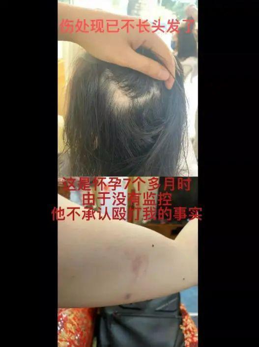快被家暴致死了，她还要给渣男道歉？