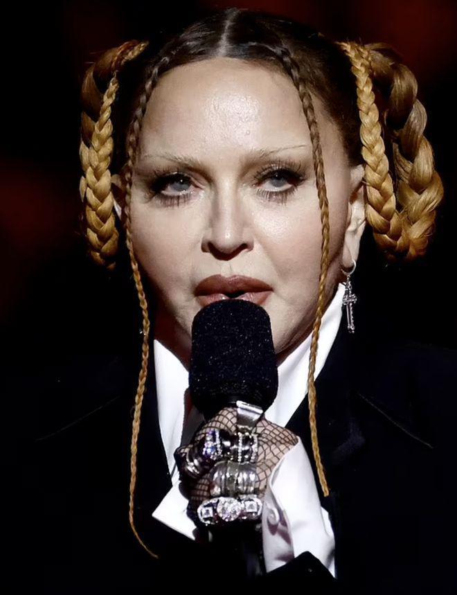 64岁麦当娜状况堪忧，橡胶脸明显走路需儿子搀扶