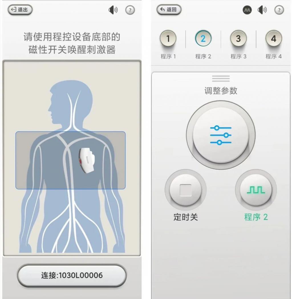南通90后在脑中植入机器，打开后，抑郁症就好了？