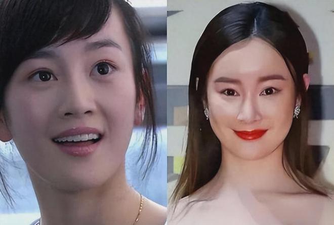 于正曝张檬已取出整容假体，整个人洋溢着自信光芒