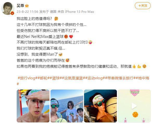 吴尊陪儿女打篮球受伤留疤 血从鼻梁伤口流下仍淡定自拍