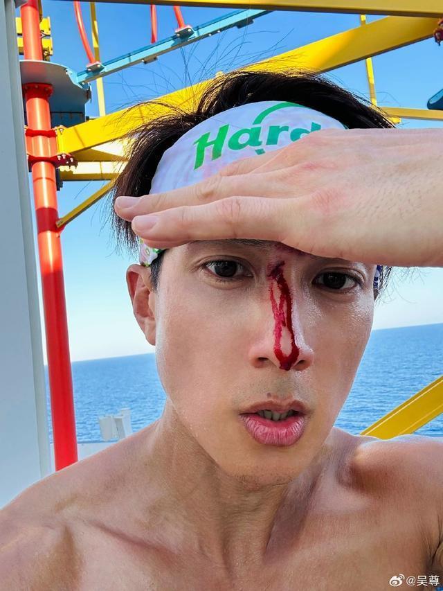 吴尊陪儿女打篮球受伤留疤 血从鼻梁伤口流下仍淡定自拍