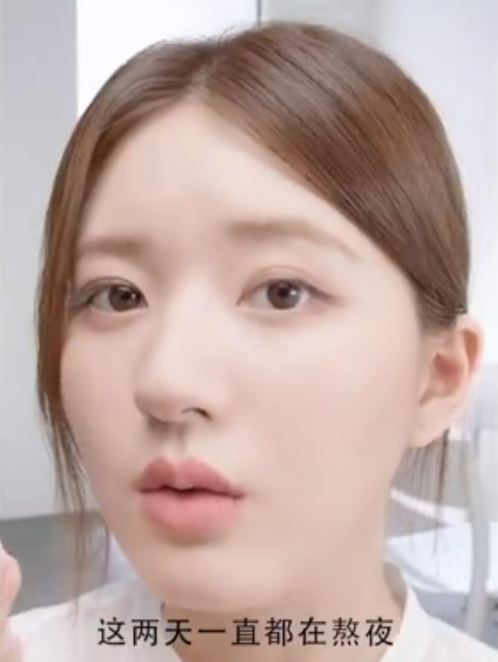 赵露思过度修图像网红，终于明白她为什么被归为“普女”