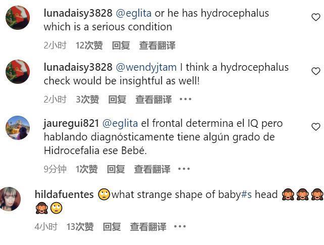 帕丽斯·希尔顿罕见晒娃，7个月宝宝额头巨大显怪异