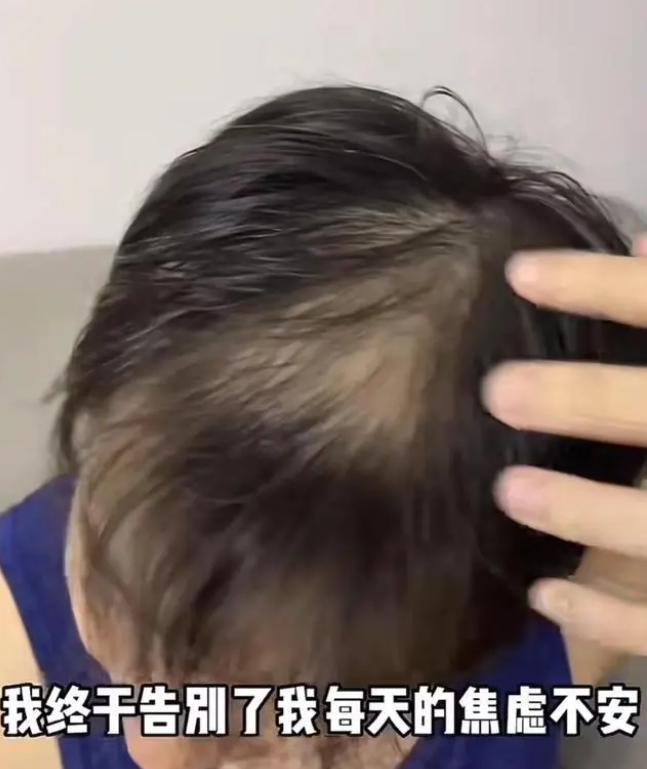 那些离开浙江卫视的主持人：抱怨工资低、出现严重脱发、被领导PUA