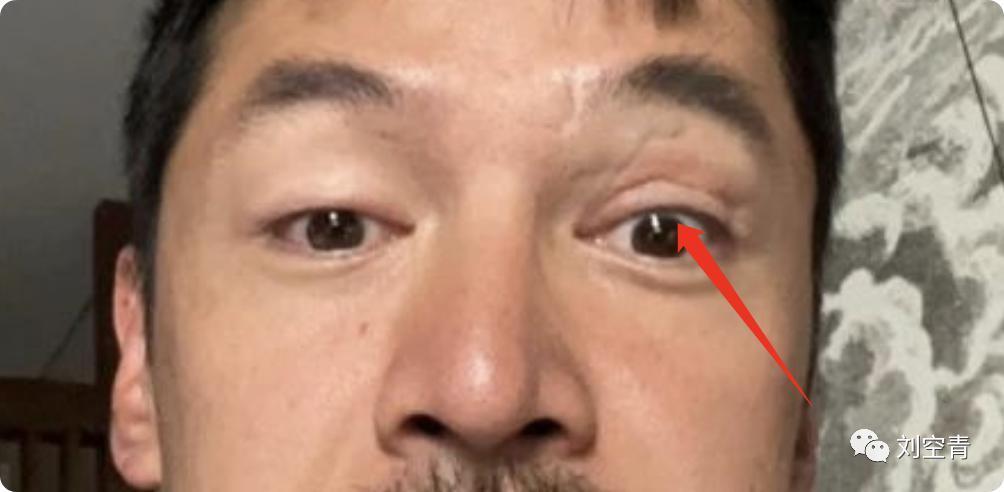 新出的大瓜，感觉他精神不对劲……