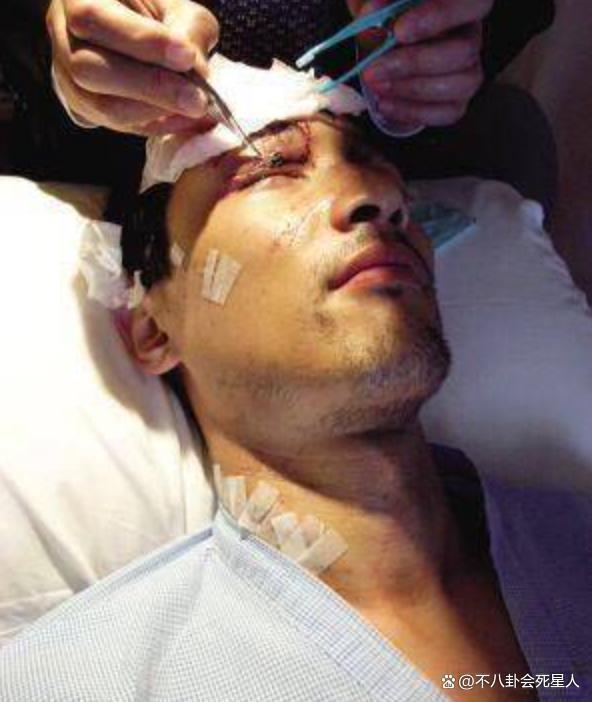 频频“发疯”的胡歌，依旧没走出17年前的那场车祸