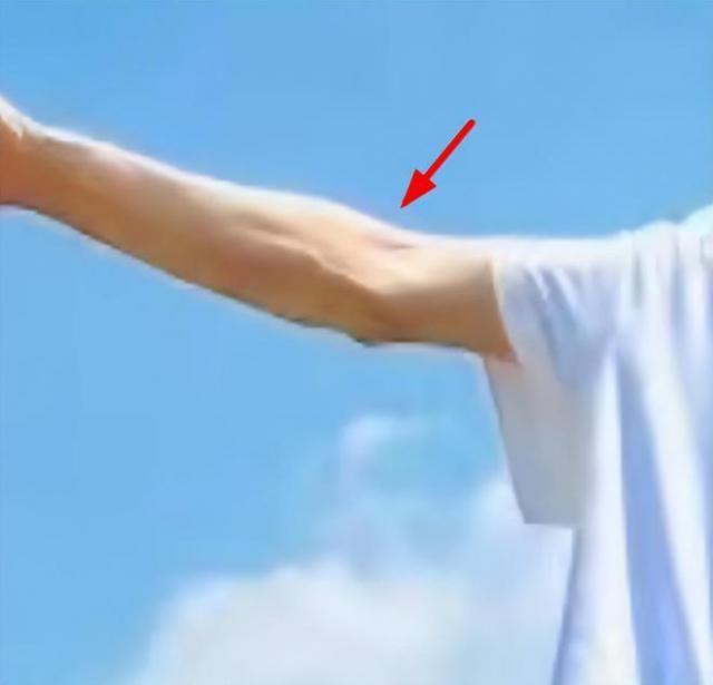 林志颖车祸后罕晒工作照，172cm暴瘦到变形，手臂上手术痕迹明显