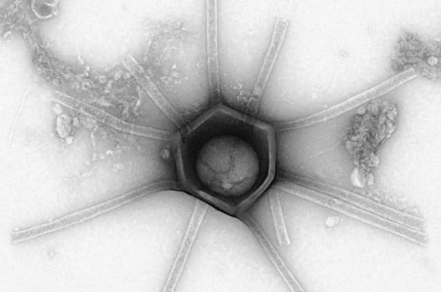 森林里发现外星病毒，地点为马萨诸塞州